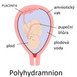 Polyhydramnion – přebytek plodové vody – příznaky, příčiny a léčba
