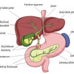 Choledocholitiáza – žlučníkový kámen ve žlučovodu – příznaky, příčiny a léčba